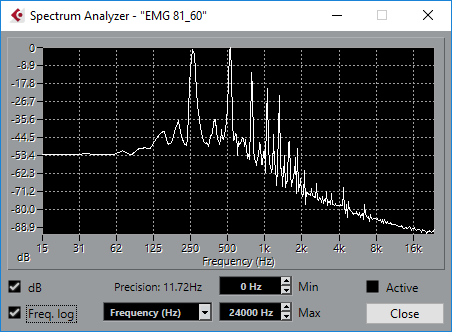 https://kiirasinstruments.com/wp-content/uploads/2021/05/EMG-81.png